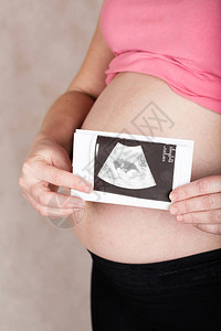 怀孕年龄在30至35岁之间的年轻孕妇保持了副秘书长图片