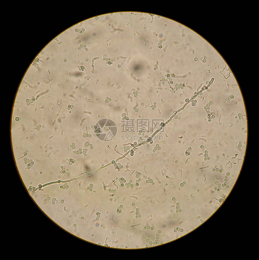 天然制剂中白色念珠菌的显微镜观察图片
