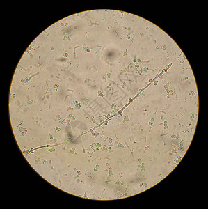 天然制剂中白色念珠菌的显微镜观察图片