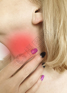 女人喉咙痛症状图片