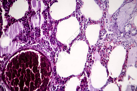 的组织病理学图片