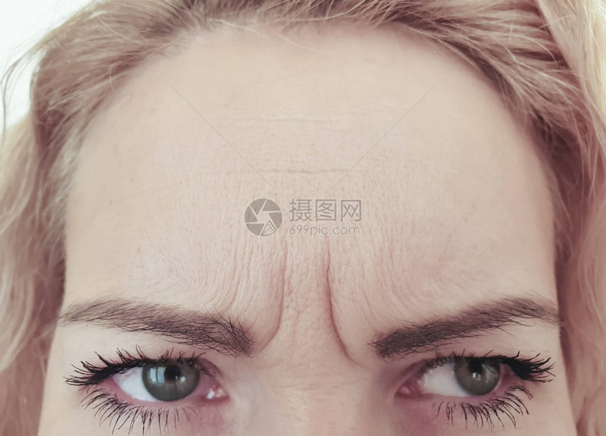 女人额头皱纹表情图片