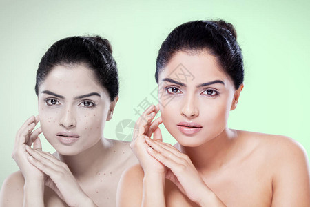 印度妇女在接受化妆品治疗前后面对的印度妇女情况比较图片