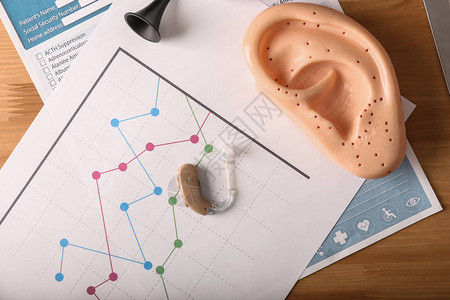 医生桌上的助听器和耳朵模型高清图片