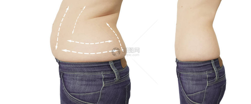 减肥前后的女人肚子图片