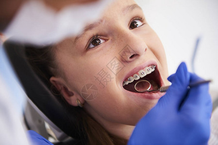 在例行牙科检查期间戴牙套的女孩图片