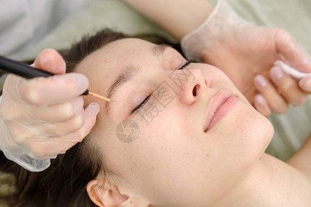 从女患者的脸上去除胎记的医学治疗使用电烙器去除痣的女皮肤科医生无线电波凝背景图片