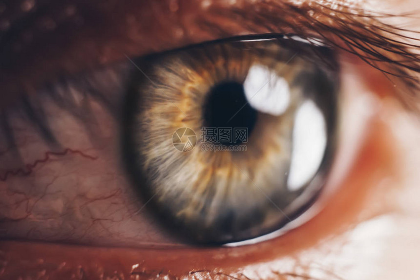 眼球被近血覆盖眼睛有视觉问题infoplain图片