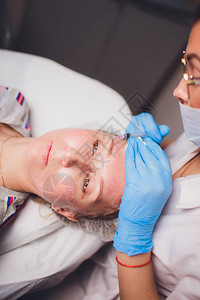 美容师在妇女脸上注射针闭合图片