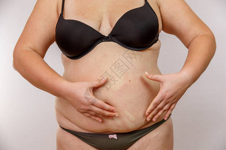 女人挤肚子女孩挤肚子上的脂肪腹部图片
