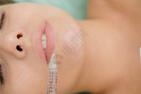 嘴唇填充剂注射丰唇盈美容塑料美容师为女病人做中胚层疗法注射器和针头图片