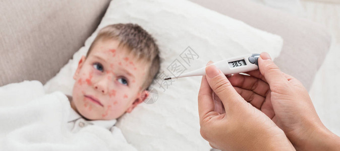 高发麻疹母亲测量生病儿子背景图片