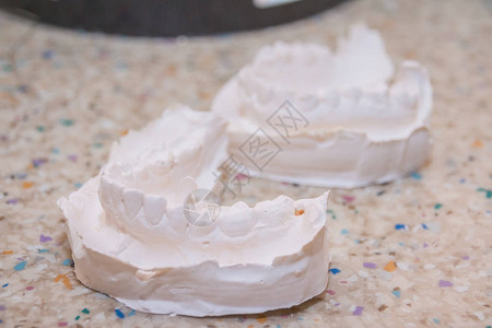 牙齿的石膏印模牙科石膏模具在牙科口腔卫生中图片