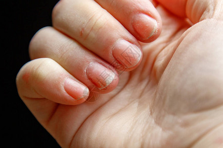短干净清晰的指甲宏的女手的指孤立在黑色背景上的白色手掌特图片