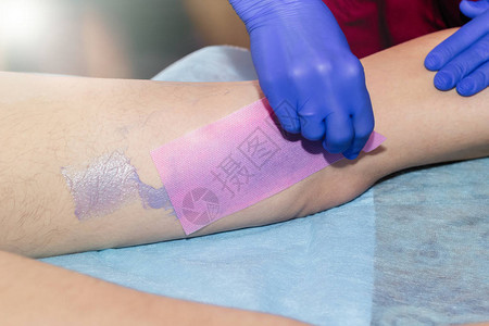 美容师在美容诊所用蜡条给女人的腿打蜡图片