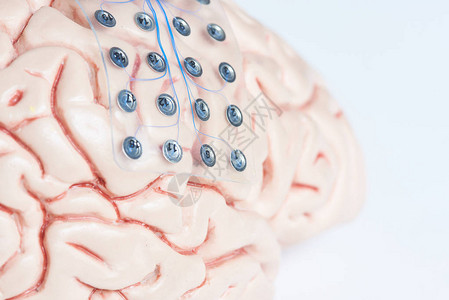 近距离观察用于脑波记录或人工大脑模型皮层电子脑摄影的次硬体图片
