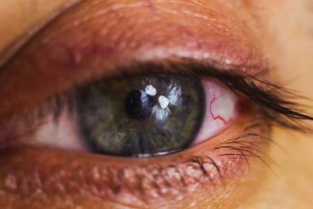 用鲜红色的动脉打开人眼关闭眼球刺激和发红瞳孔虹膜睫毛在宏图片
