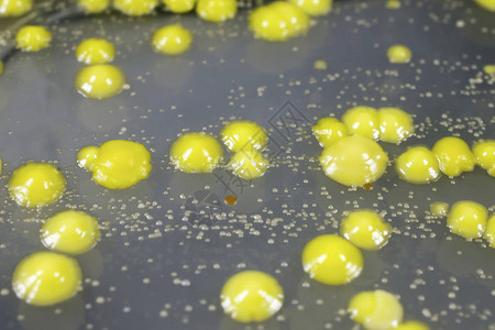 用营养琼脂培养皿上皮肤涂片黄微球菌和表皮葡萄球菌落生长的细图片