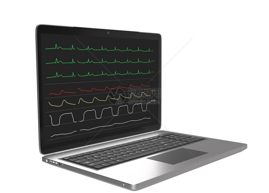 手术室笔记本电脑上麻醉患者生命体征的监测图显示图片