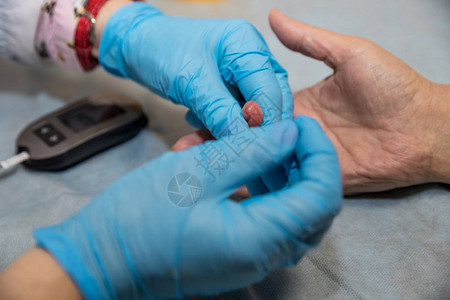 青年女医生使用高男病人手指液压计图片