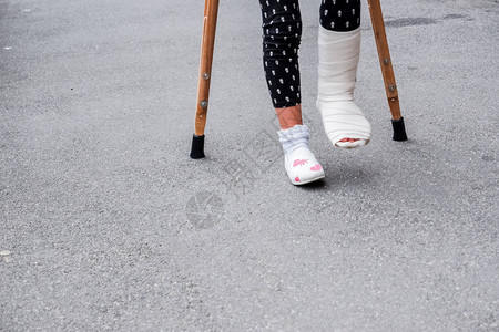 整形外科的女孩拄着拐杖走在马路附近的街道上图片