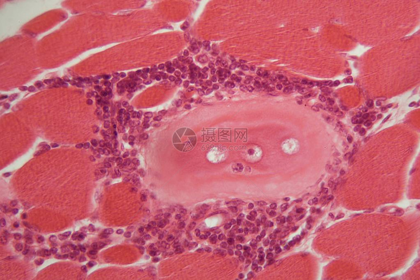 在显微镜下的肌肉组织中图片
