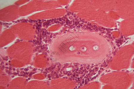 在显微镜下的肌肉组织中图片