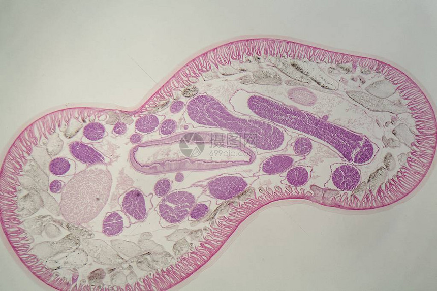 通过寄生线虫Ascarissp的横截图片