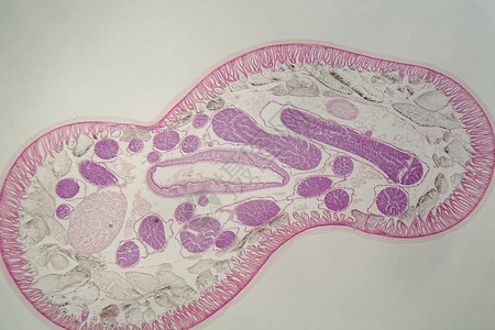 通过寄生线虫Ascarissp的横截高清图片