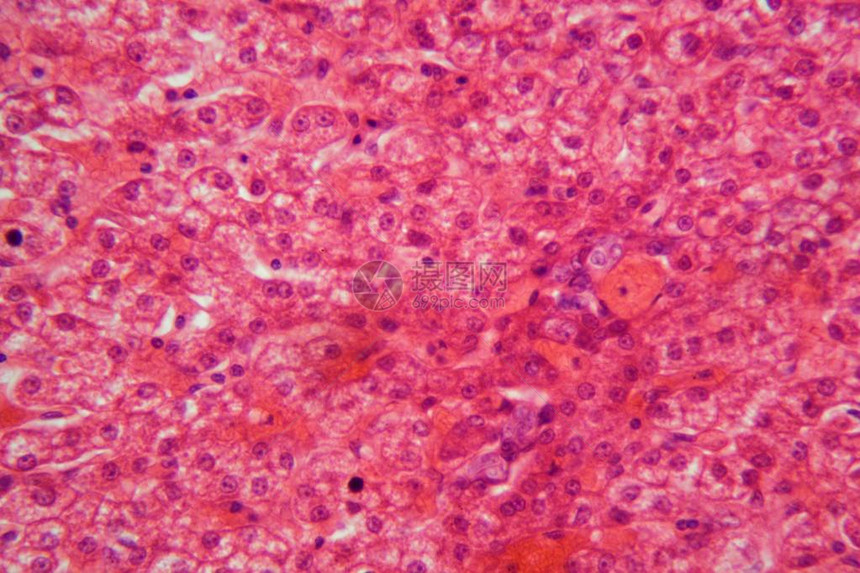 猪肝切片的显微镜照片图片