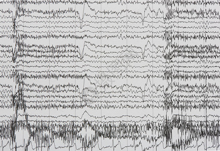 纸上人类脑电图或脑电图的脑电波成像图片