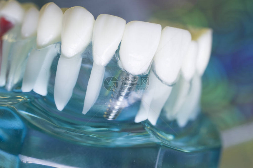 牙科医生完美的白牙教授牙齿塑料模型图片