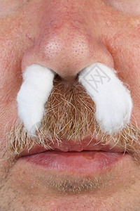 老年过敏老人将棉网塞进鼻子过滤空气工图片
