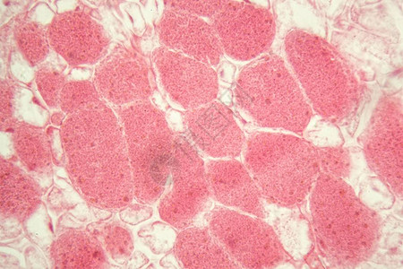 显微镜下豆根中的根细菌结节高清图片
