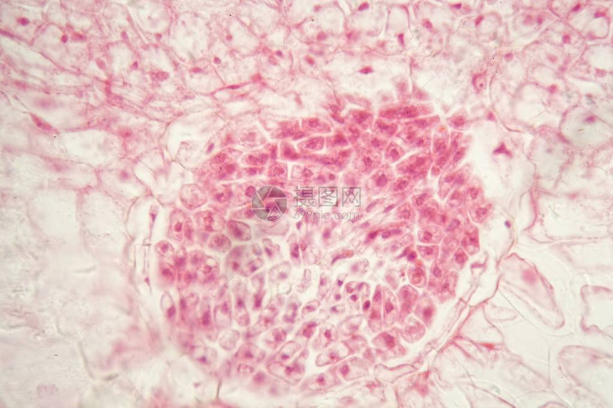 显微镜下豆根中的根细菌结节图片
