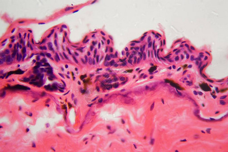 显微镜下两栖动物皮肤溃疡的细胞图片
