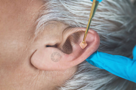 或用柔按摩黄铜耳笔对人耳进行耳膜治疗背景图片