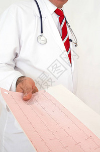医生打印心脏监测器报告图片