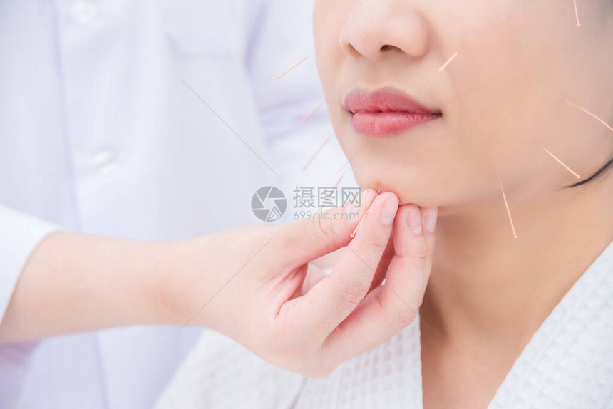 亚洲妇女在诊所接受面部针灸治疗图片