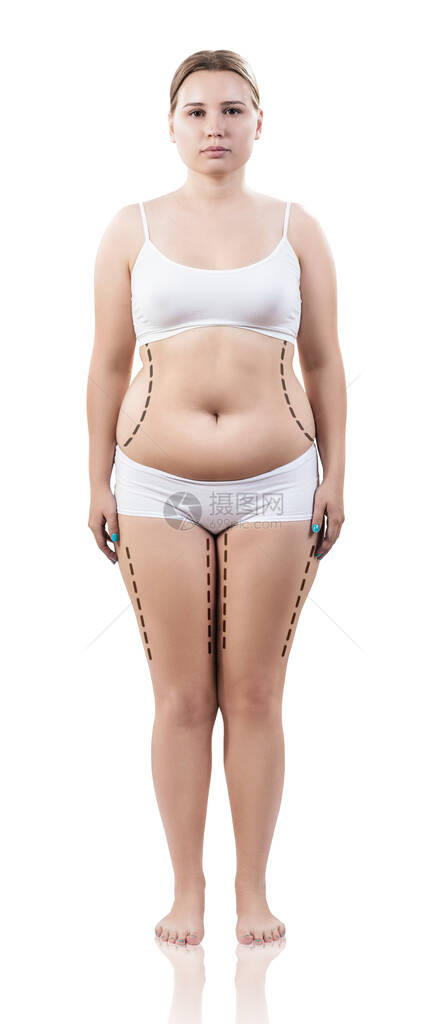 身体上有虚线的胖女人减肥和抽脂切除图片