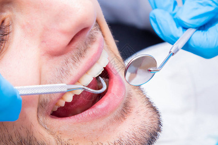 患者口腔中牙医工具的特写图片