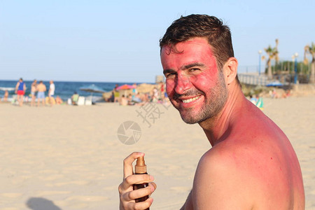 男子在海滩晒伤图片
