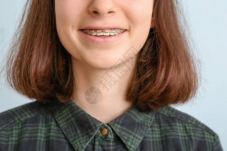青少年女孩有牙套的图片