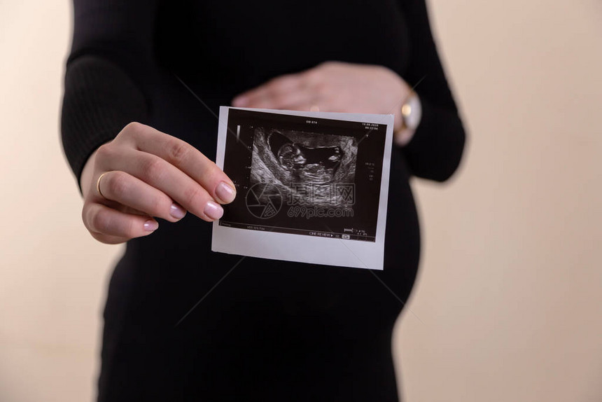 年轻孕妇在腹部持有超声图片的裁剪图像怀孕保健妇科医学的概念妈在等宝特写图片