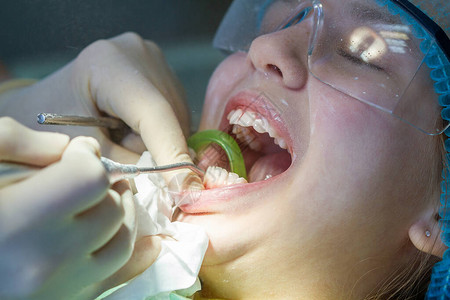 检查孩子口腔洞和牙齒请看牙医图片