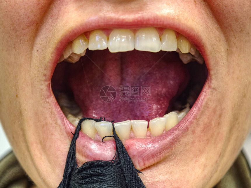 女人用布条张开嘴露出她歪扭的牙齿女张图片