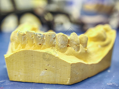 牙科化验室中的黄石膏模型整形牙医为恢复图片