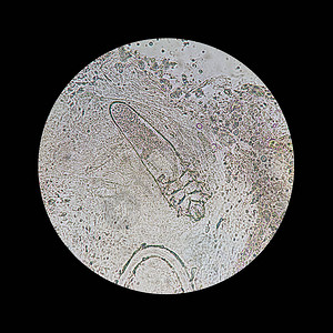 从显微镜视图中脱modexmite引起皮肤疾病的寄生虫Demod图片