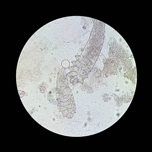 从显微镜视图中脱modexmite引起皮肤疾病的寄生虫Demod图片