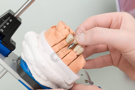牙科化验室植入动脉器的高清图片
